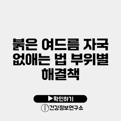 붉은 여드름 자국 없애는 법 부위별 해결책